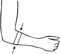 Bort EpiContur® Ellenbogenbandage